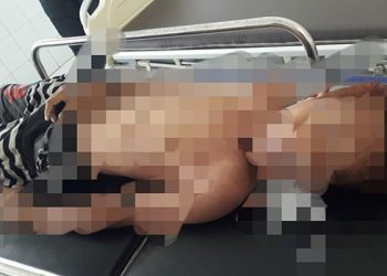 Remaja 13 Tahun Tewas Tenggelam Di Kolam Renang Hotel