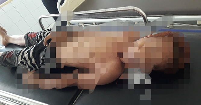 Remaja 13 Tahun Tewas Tenggelam Di Kolam Renang Hotel