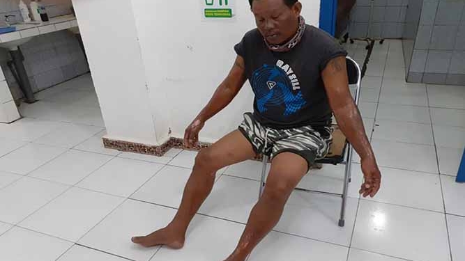 Polisi Usut Kasus Kebakaran Speed Bout di Mappi