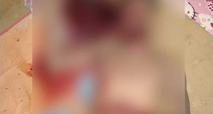 Seorang Pria Tewas Setelah Dianiaya Istrinya Di Keerom