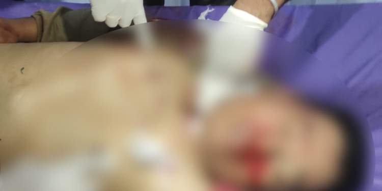 Polisi Dalami Aksi OTK, Yang Berakibat Jatuhnya Korban Seorang Warga Sipil di Lanny Jaya