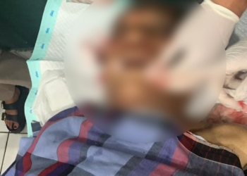 Terkena Tembakan di Pipi Kanan, Mantan Kapolsek Mulia Meninggal, Lalu di Terbangkan ke Kab. Mimika