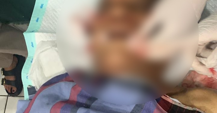 Terkena Tembakan di Pipi Kanan, Mantan Kapolsek Mulia Meninggal, Lalu di Terbangkan ke Kab. Mimika