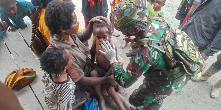 Pertolongan Cepat Satgas Yonif 743/PSY Obati Anak Korban Kecelakaan di Yambi Puncak Jaya