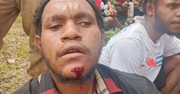 6 Anggota KNPB Ditangkap, Beberapa Aktivis lainnya Diduga Dipukul Polisi di Sentani Jayapura