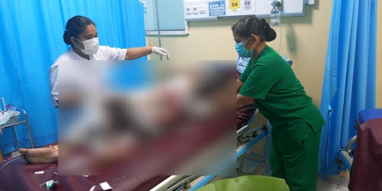 Anak 15 Tahun Tewas Diduga Dibakar Orang Tua di Sentani Timur